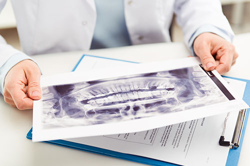 Tooth-Colored Fillings Will Keep Your Smile Healthy