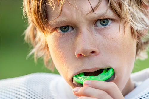 Prevent Dental Emergencies With Custom Sports Mouthguards